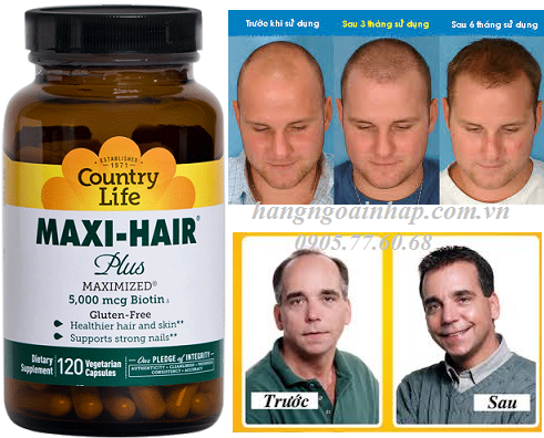 Thuốc Mọc Toc Trị Hoi đầu Maxi Hair 5000 Mcg 120 Vien