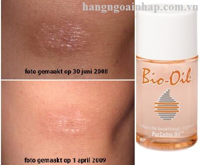 Tinh Dầu Bio-Oil 60ml của Úc - kem Chống rạn da, làm mờ sẹo