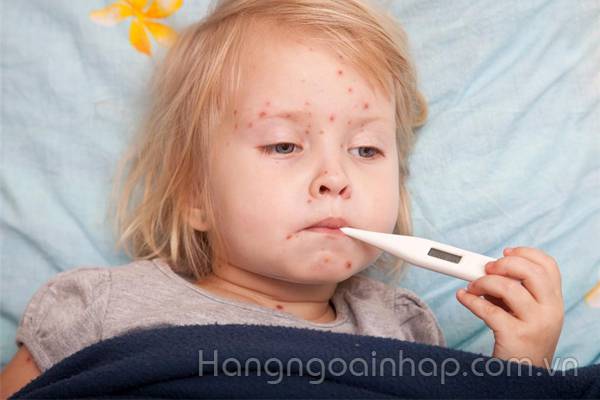 những loại bệnh thường gặp ở bé trong mùa thu