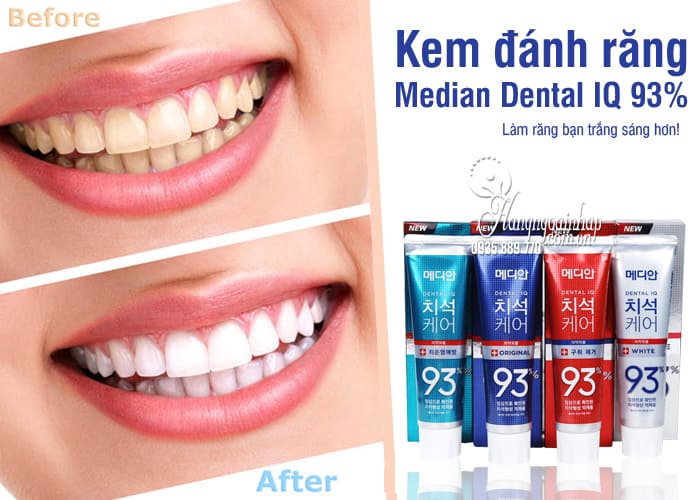 Kem đánh răng Median 86%, Median Dental IQ 93% Hàn Quốc  8