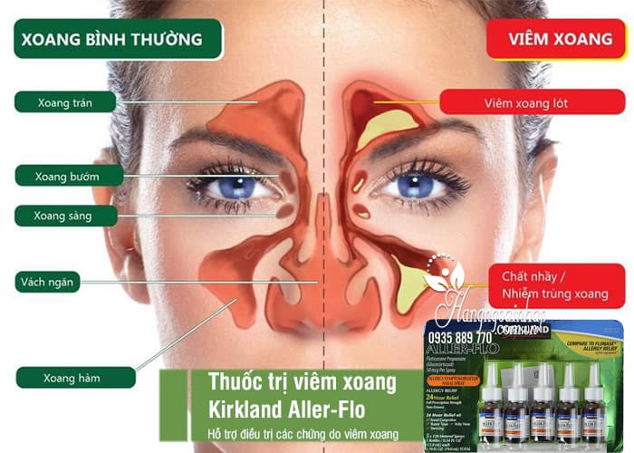 Thuốc trị viêm xoang Kirkland Aller-Flo bộ 5 lọ chính hãng Mỹ 7