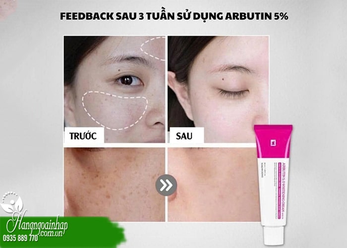 5 lưu ý khi sử dụng kem trắng da Arbutin 5.0 Tosowoong  8