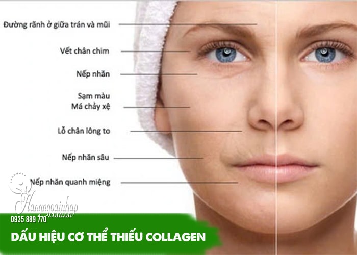 5 sai lầm khi dùng collagen gây phản tác dụng  45