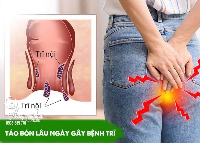 Bị táo bón nên ăn gì để đi vệ sinh dễ dàng? Chuyên gia khuyên 3