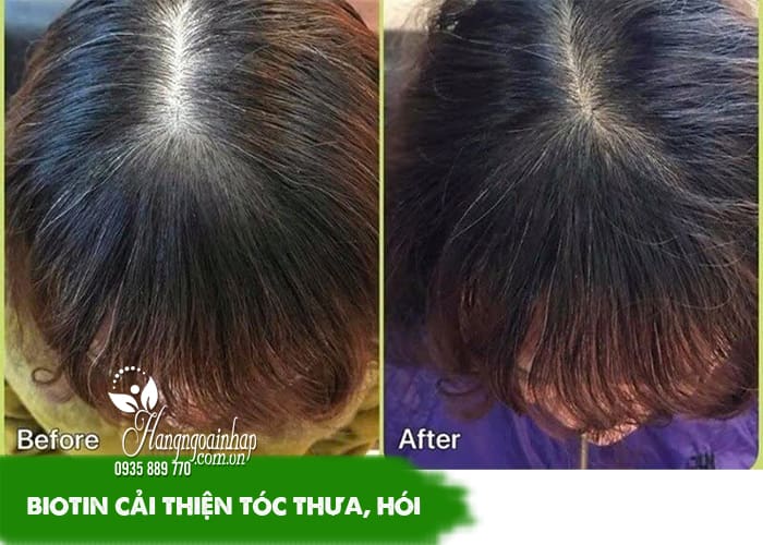  Biotin của Mỹ loại nào tốt? Top 4 loại hot nhất hiện nay 78