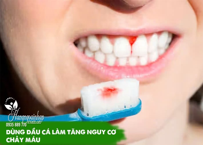 Tác dụng phụ của dầu cá, đọc ngay trước khi muốn bổ sung 9