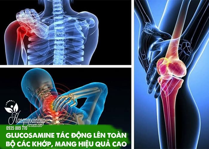 Tác dụng phụ của Glucosamine 5