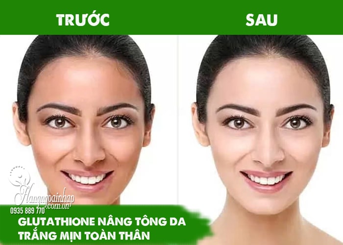 Tác dụng phụ của thuốc Glutathione trắng da, chị em nên biết 23