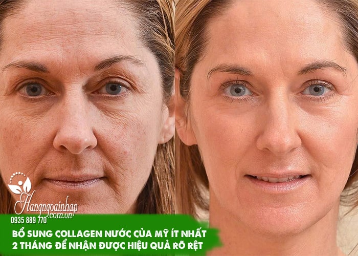 Top 3 collagen nước của Mỹ đáng mua nhất  32