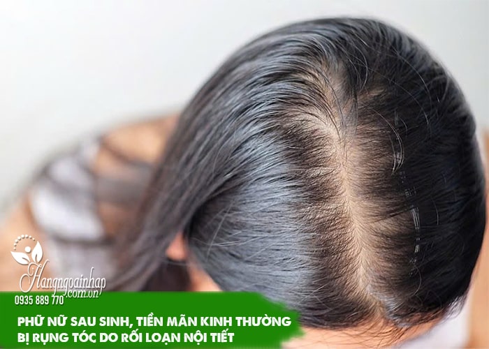 Top 7 thuốc mọc tóc tốt nhất hiện nay cho nam và nữ 12