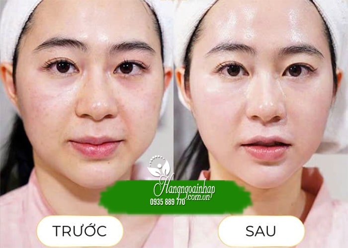 Top serum phục hồi da sau treatment, da nhạy cảm  89