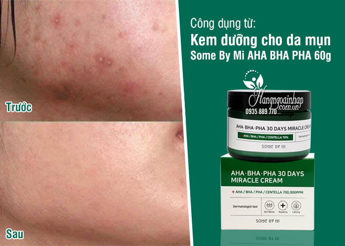 Kem dưỡng cho da mụn Some By Mi AHA BHA PHA 60g 1