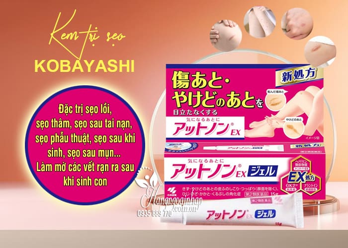 Kem trị sẹo Kobayashi của Nhật Bản tuýp 15g 767