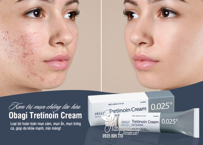 Kem trị mụn chống lão hóa Obagi Tretinoin Cream 0,025% Mỹ  3