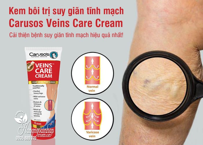 Kem bôi trị suy giãn tĩnh mạch Carusos Veins Care Cream 75g 5