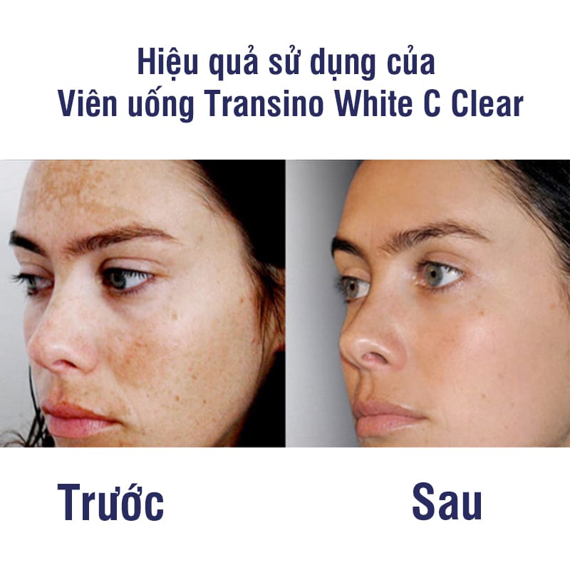 Viên uống Transino White C Clear 120 viên mẫu mới nhất