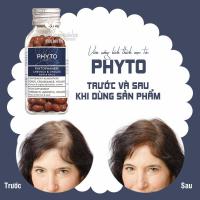 Viên uống kích thích mọc tóc Phyto chính hãng Pháp 120 viên