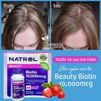 Viên ngậm mọc tóc Natrol Beauty Biotin 10000mcg 250 Tablets