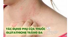 Tác dụng phụ của thuốc Glutathione trắng da, chị em nên biết