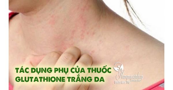 Tác dụng phụ của thuốc Glutathione trắng da, chị em nên biết