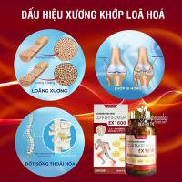 Bổ khớp Chondroitin MSM EX 1800 Eikenbi của Nhật Bản 