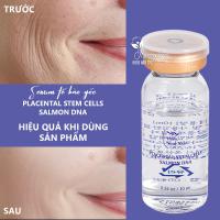 Serum tế bào gốc Placental Stem Cells Salmon DNA 5 lọ