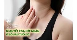 Bí quyết xóa nếp nhăn ở cổ sau tuổi 30