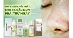 Top 3 serum tốt nhất cho da dầu mụn phải thử ngay