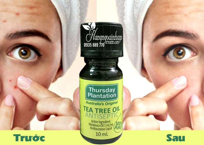 Tinh dầu tràm trà trị mụn Thursday Plantation Tea Tree Oil 10ml  của úc